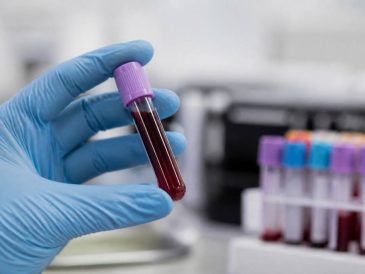 Cbd im blut nachweisbar: wie lange bleibt cbd im körper?