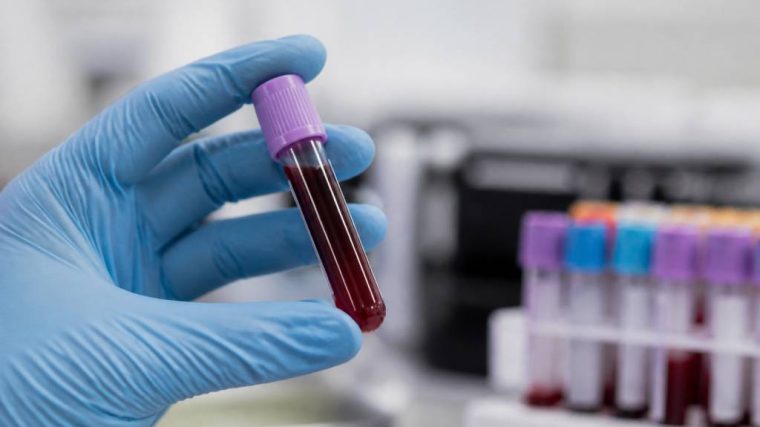 Cbd im blut nachweisbar: wie lange bleibt cbd im körper?