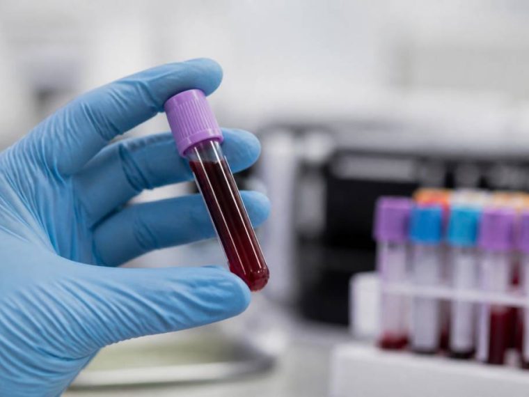 Cbd im blut nachweisbar: wie lange bleibt cbd im körper?