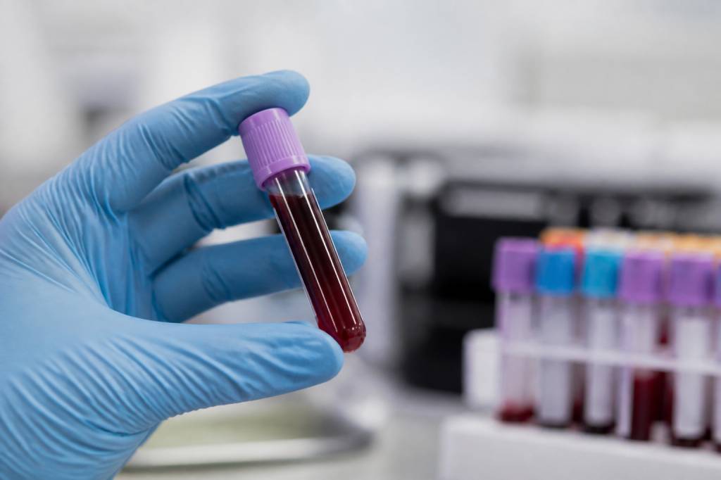 Cbd im blut nachweisbar: wie lange bleibt cbd im körper?